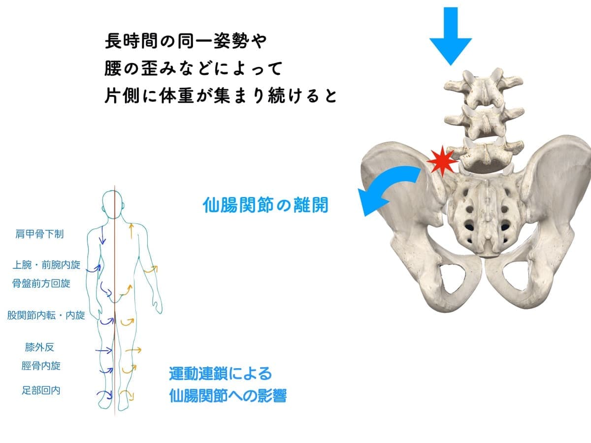 上半身の状態と仙腸関節の障害