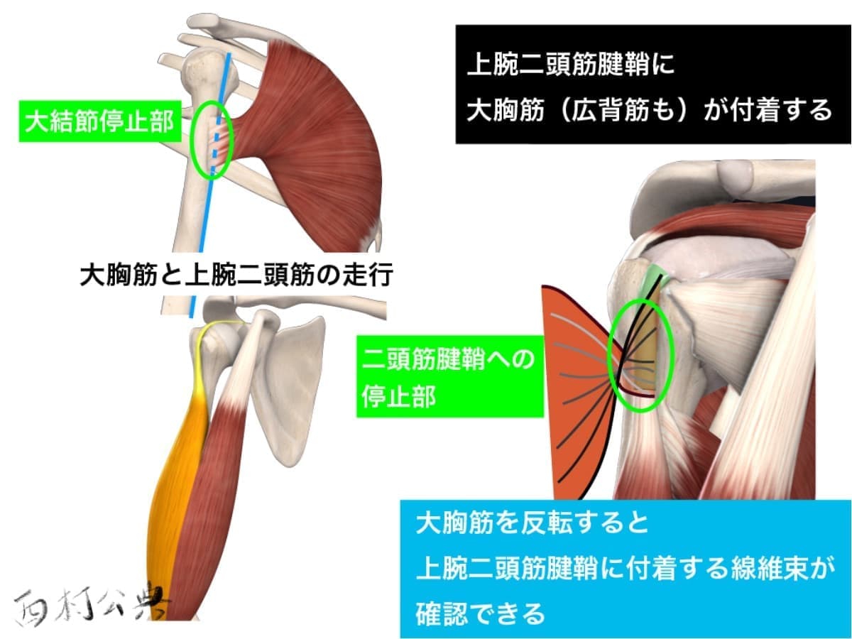 上腕二頭筋腱鞘と大胸筋の関わり